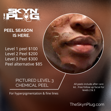 Chemical peels 